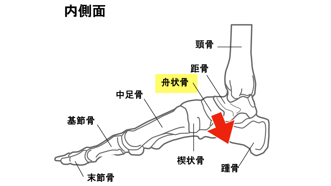 扁平足 姿勢 足の張り 足のスタイルにも影響 扁平足の原因 扁平足の解消のための足裏エクササイズ 足のアーチ筋トレ 大阪市阿倍野区のパーソナルトレーニングなら個室ジムどこでもフィット御堂筋線西田辺